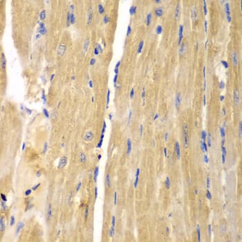 SLC25A13 / CITRIN Antibody