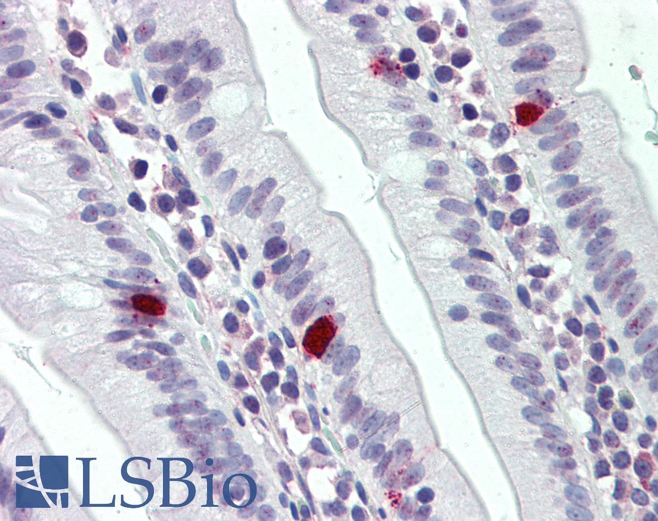 IHC-plus™ Polyclonal Rabbit anti-Human THEM6 / C8orf55 Antibody (N-Terminus, IHC)