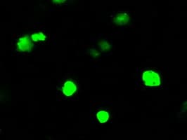 ARHGDIA / RHOGDI Antibody (clone OTI1A7)