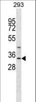 GLYAT Antibody (aa171-199)