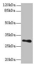 Polyclonal Rabbit anti-Human TMEM176B / LR8 Antibody (IHC, WB)