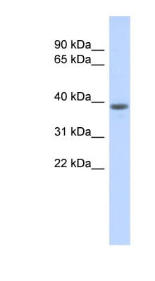 DCAF4L1 Antibody (aa323-372)
