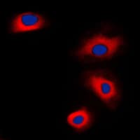 VASP Antibody (Internal)