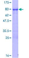 Human JMJD6 / PSR Protein (Recombinant GST)