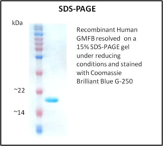 Human GMF Beta / GMFB Protein (Recombinant)