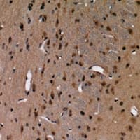 ADGRE5 / CD97 Antibody