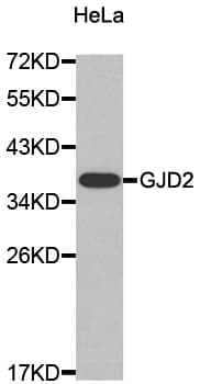 Polyclonal Rabbit anti-Human GJD2 / CX36 / Connexin 36 Antibody (WB)