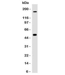 CA9 / Carbonic Anhydrase IX Antibody (clone CBAD9-1)