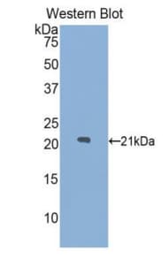 LAMP2 / CD107b Antibody (aa29-192)