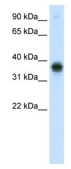 E2F3 Antibody (C-Terminus)