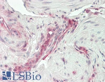 IHC-plus™ IL11 Antibody