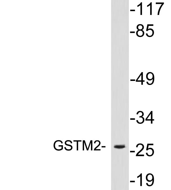 GSTM2 Antibody (aa38-87)