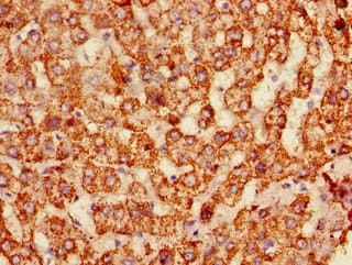 ALDH6A1 Antibody