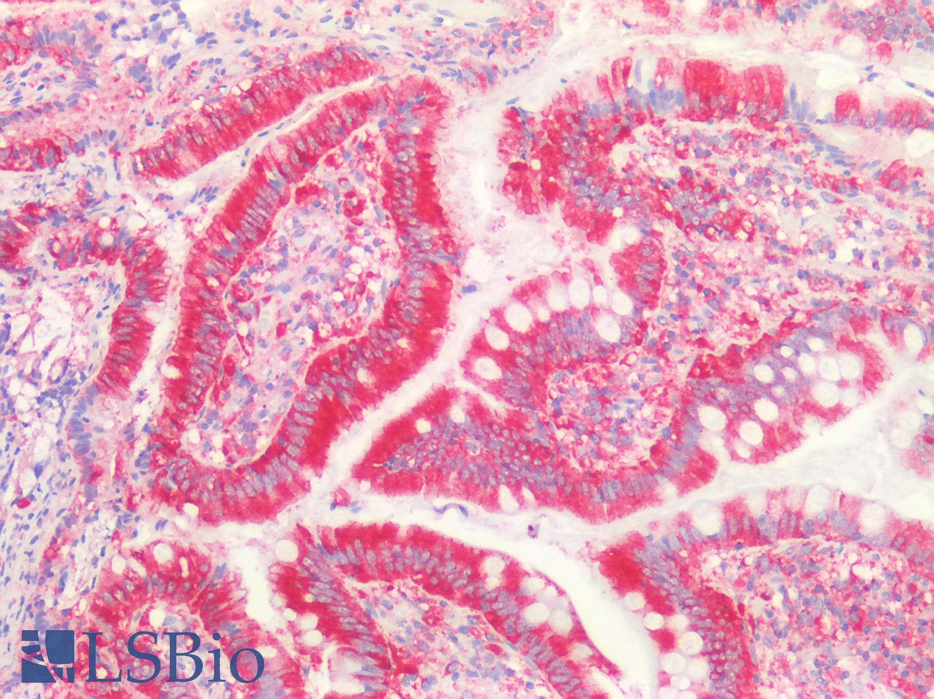 PathPlus™ MVP / VAULT1 Antibody (aa158-380)