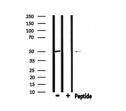 PSMD12 / Rpn5 Antibody