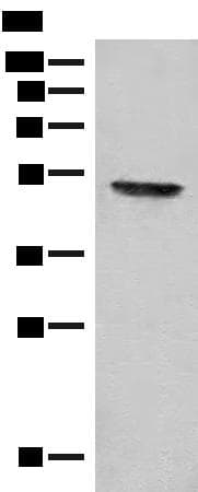 FGL2 Antibody