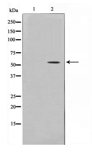 Polyclonal Rabbit anti-Human NR1A2 / THRB Antibody (IHC, WB)