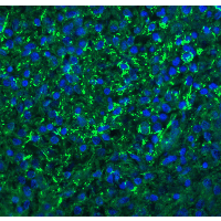 IHC-plus™ Polyclonal Rabbit anti-Human CXCR6 Antibody (IHC, IF, WB)