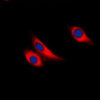 LGALS9 / Galectin 9 Antibody (Internal)