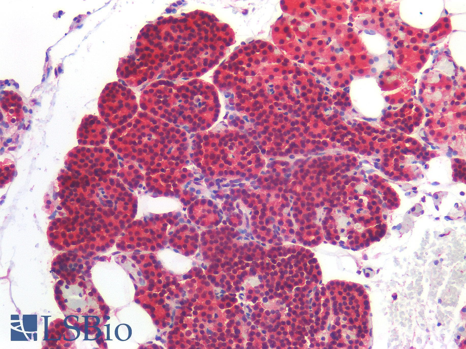IHC-plus™ ROR1 Antibody (Internal Region)