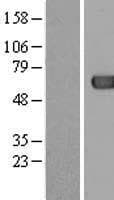 ACOT12 Protein (Over-Expression Lysate Myc-DDK (Flag))