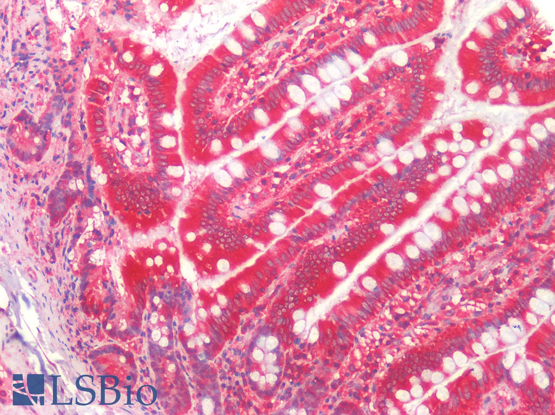 PathPlus™ Monoclonal Mouse HTT / Huntingtin Antibody (clone HDC8A4, aa2703-2911, IHC, WB)