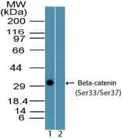 Polyclonal Rabbit anti-Human CTNNB1 / Beta Catenin Antibody (phospho-Ser33/37, WB)