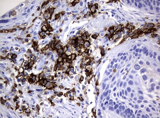 CD32A Antibody (clone UMAB60)