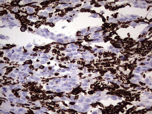 Vimentin Antibody (clone UMAB160, Carrier-free)