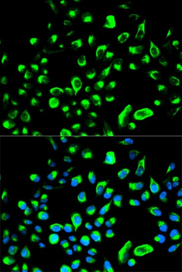 YWHAQ / 14-3-3 Theta Antibody