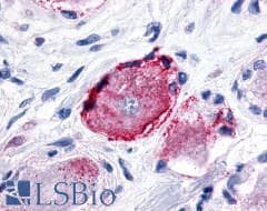PathPlus™ Polyclonal Rabbit anti-Human MRGPRX3 / MRGX3 Antibody (Extracellular Domain, IHC)