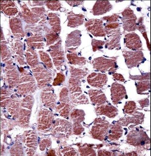RGS9 Antibody (aa149-178)