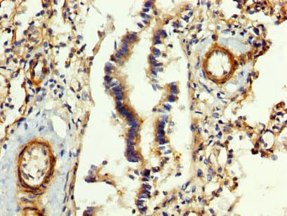 Polyclonal Rabbit anti-Human FGB / Fibrinogen Beta Chain Antibody (IHC)
