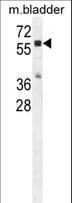 IHC-plus™ Polyclonal Rabbit anti-Human CTSA / Cathepsin A Antibody (aa18-45, IHC, WB)