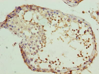 Polyclonal Rabbit anti-Human CLGN / Calmegin Antibody (IHC, WB)
