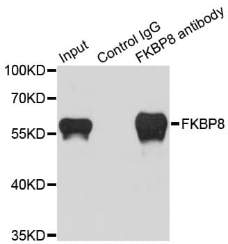 IHC-plus™ FKBP38 / FKBP8 Antibody (aa60-270)