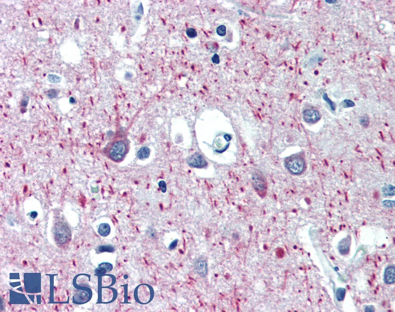 PathPlus™ MAP2 Antibody (clone 5F9)