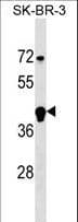 Polyclonal Rabbit anti-Human FBXL12 Antibody (aa277-303, WB)