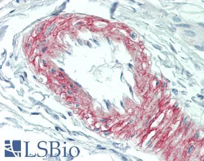 IHC-plus™ LAMA5 / Laminin Alpha 5 Antibody (2350-2430 aa, Internal)