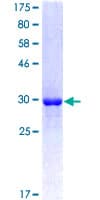 Human ATP6V0D2 Protein (Recombinant GST, N-terminus)