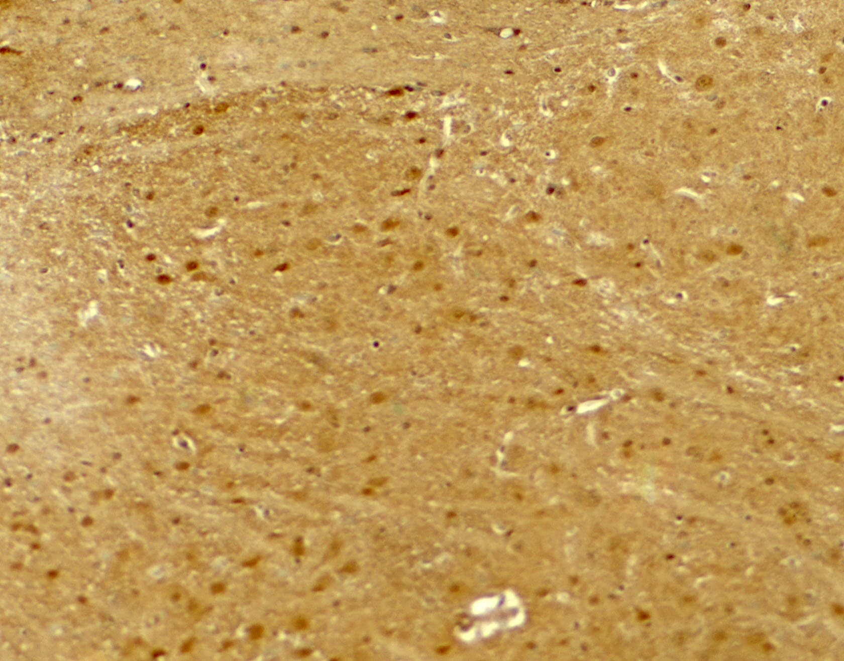 IHC-plus™ NLGN2 / Neuroligin 2 Antibody