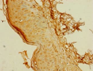 C8orf34 Antibody