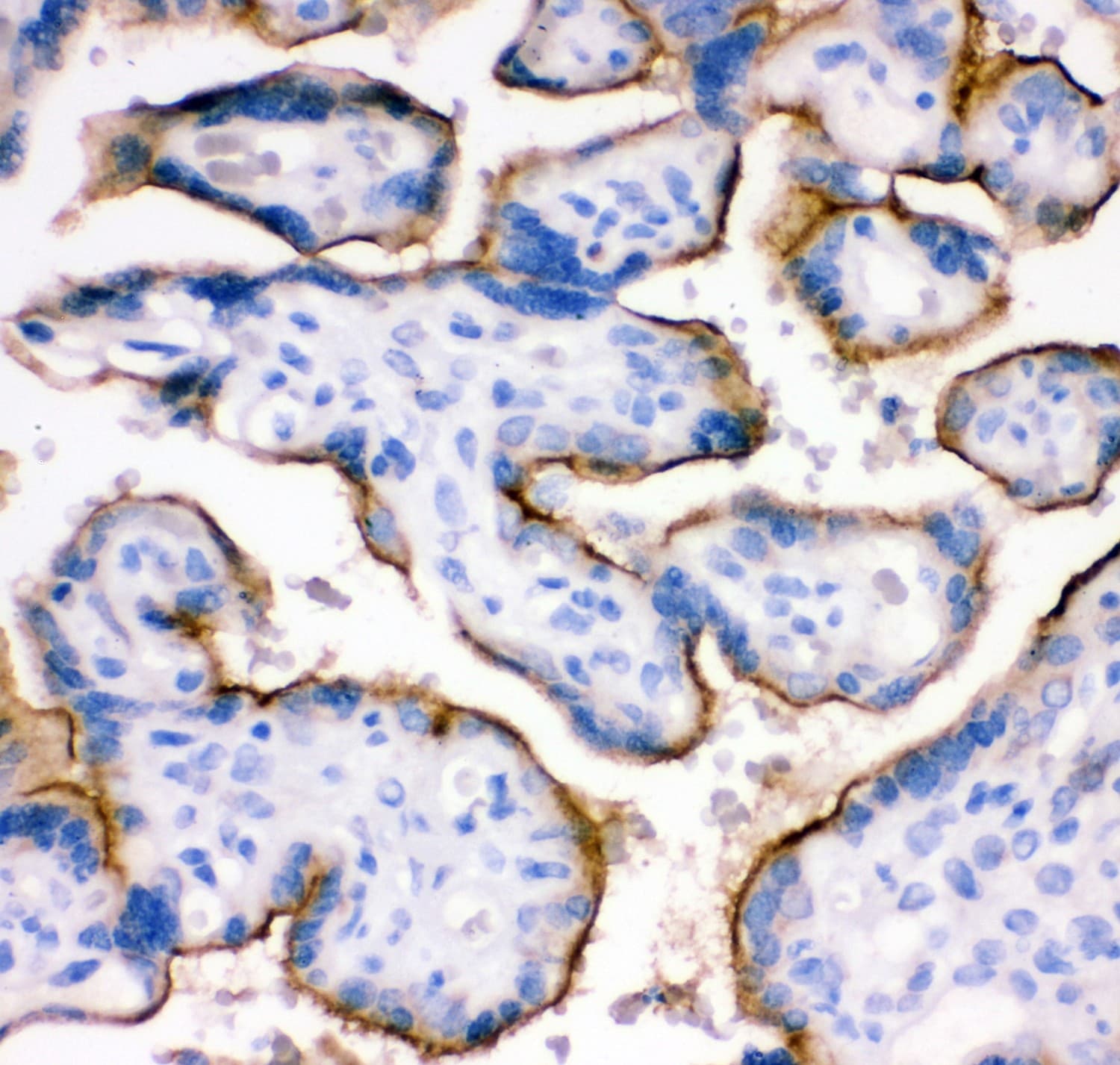 CD71 / Transferrin Receptor Antibody (aa1-198)