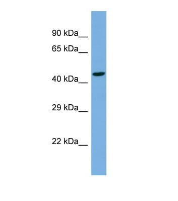 Polyclonal Rabbit anti-Human TBC1D22A Antibody (aa221-270, WB)