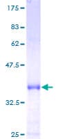Human PCNA-Associated Factor Protein (Recombinant GST)