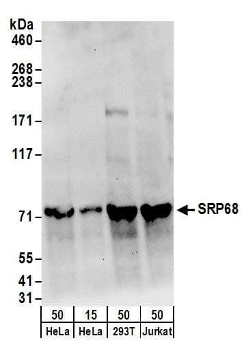 IHC-plus™ Polyclonal Rabbit anti-Human HUPF2 / UPF2 Antibody (aa1-50, IHC, WB)