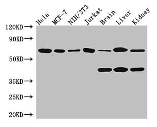 Polyclonal Rabbit anti-Human PRMT4 / CARM1 Antibody (IHC, IF, WB)