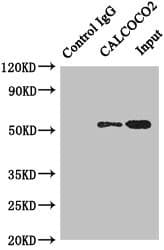 CALCOCO2 Antibody