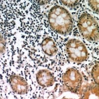 INA / Alpha Internexin Antibody