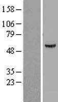 ATP6V1B1 Protein (Over-Expression Lysate Myc-DDK (Flag))